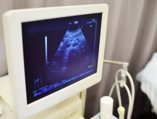 Rozwój i ewolucja badania ultrasonograficznego